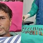 পেটে ব্যথা, অস্ত্রোপচারে মিলল ২৯ চামচ–১৯ টুথব্রাশ!