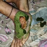 রাসেল ভাইপারের আতঙ্ক, প্রাণ হারিয়েছেন পাঁচ-ছ’জন