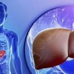 ফ্যাটি লিভার সমাধানে করণীয়