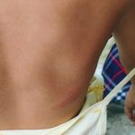 পরীক্ষার পর প্রথম শ্রেণির ছাত্রীকে মারধর! বানারহাটে চাঞ্চল্য