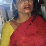 ভাঙড়ে আইএসএফ-তৃণমূল সংঘর্ষ, আহত উভয় পক্ষের একাধিক কর্মী